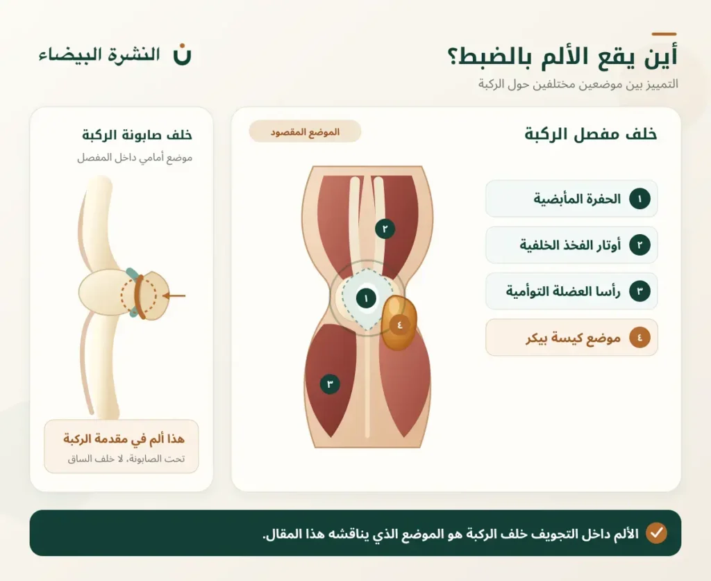 رسم يوضح موضع الألم خلف مفصل الركبة والفرق بينه وبين الألم خلف صابونة الركبة